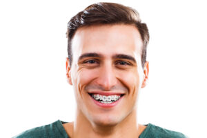 Professional Orthodontic Treatment in Houston, Texas