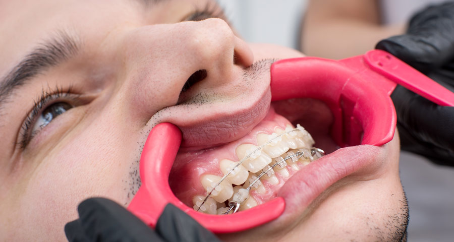 Affordable Modern Orthodontic Care in Houston, Texas