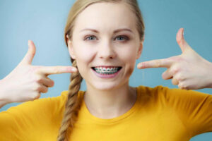 Straighten Your Teeth with Braces in Houston, Texas