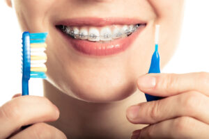 Professional Toothbrush for Braces in Houston, Texas