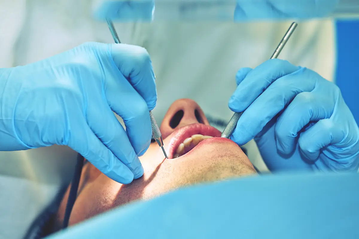 Root Canal or Tooth Extraction: Making the Right Dental Decision