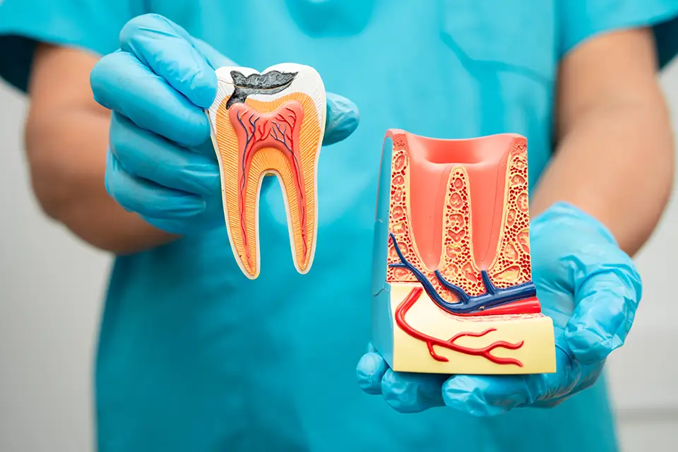 Tooth Infections: Uncover the Secrets of Effective Treatment