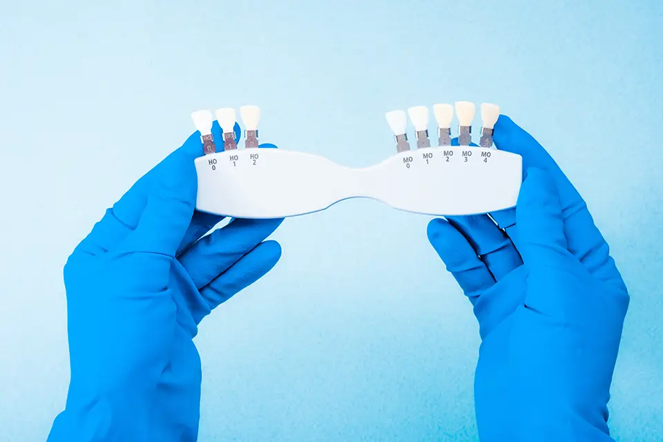 No-Prep Veneers: What You Need to Know Before You Decide