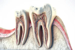 Root Canal Cost in Houston