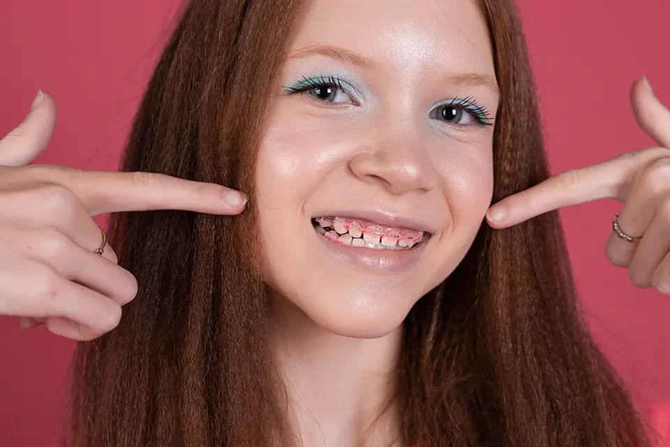 The Best Braces Colors For Girls