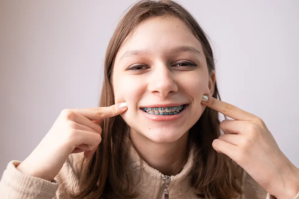 orthodontics - Zara Dental Clinic - Houston Rubber Bands in Houston, Texas