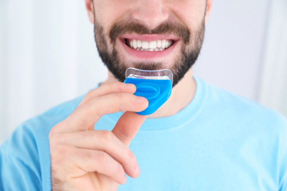 Teeth Whitening at Home: A Comprehensive Guide