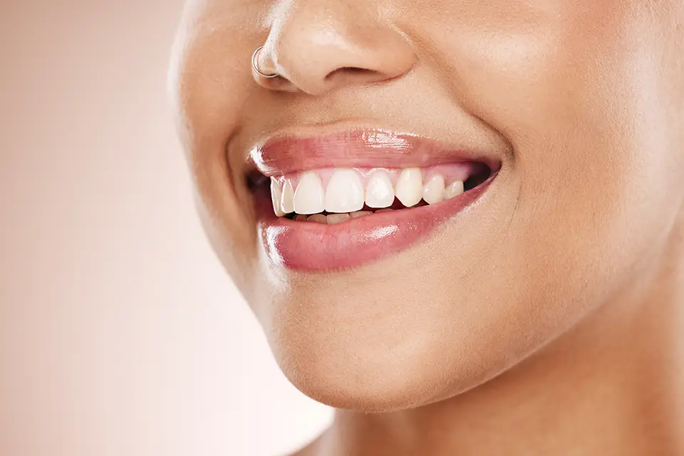 Natural Teeth Whitening: A Comprehensive Guide