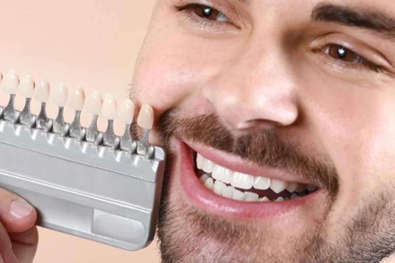 Corona Dental para Diente Frontal