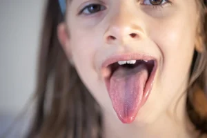 Bultos en la Parte Posterior de la Lengua