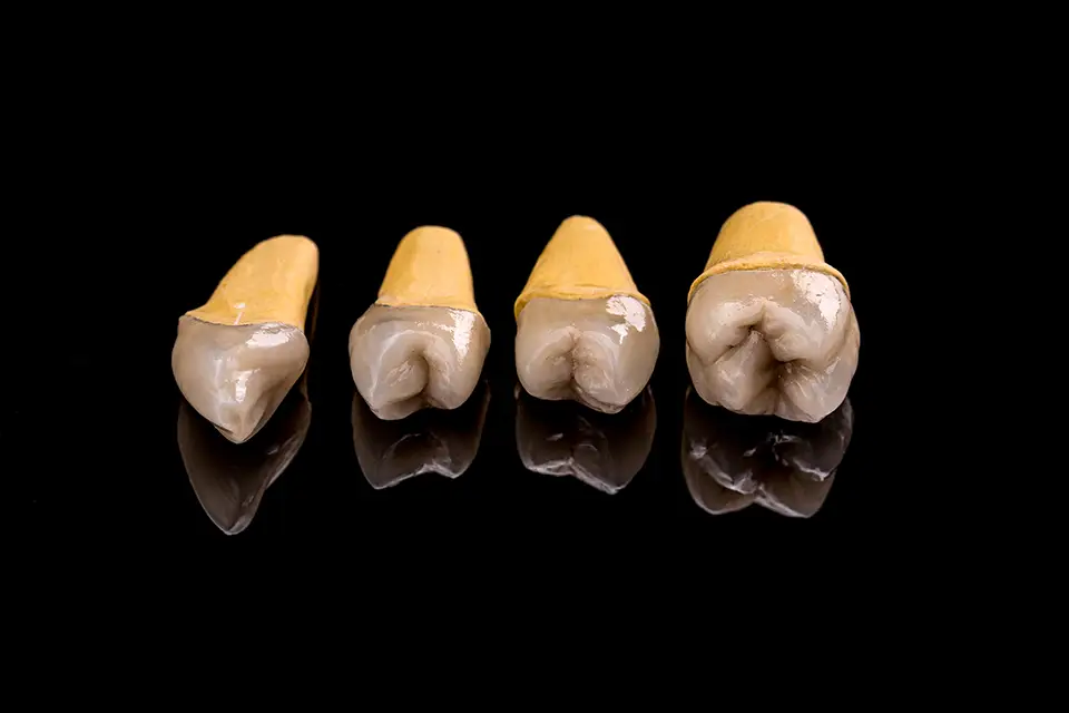 Coronas de Porcelana