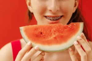 Soft Foods for Braces: A Complete Guide
