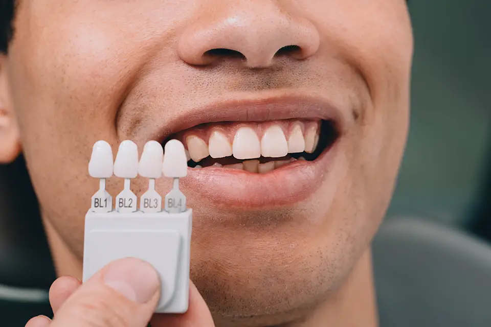 dental veneers - Zara Dental Clinic - Houston Discover the Best Dental Veneers at Zara Dental in Houston, Texas