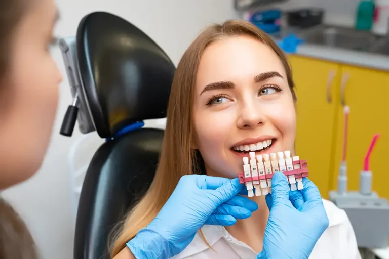 Composite Veneers