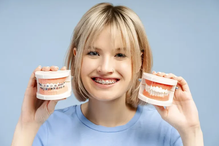 Ceramic Braces: Discreet Orthodontics That Fit Real Life