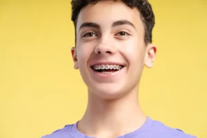 Braces Best Time for Kids: When to Start and Why