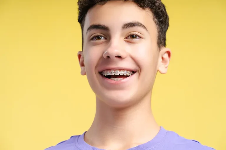 portrait-of-smiling-curly-haired-boy - Zara Dental Clinic - Houston Braces Best Time for Kids: When to Start and Why