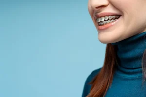 Metal Braces vs Invisalign in Houston: Cost, Comfort, Treatment Time, and Best Fit