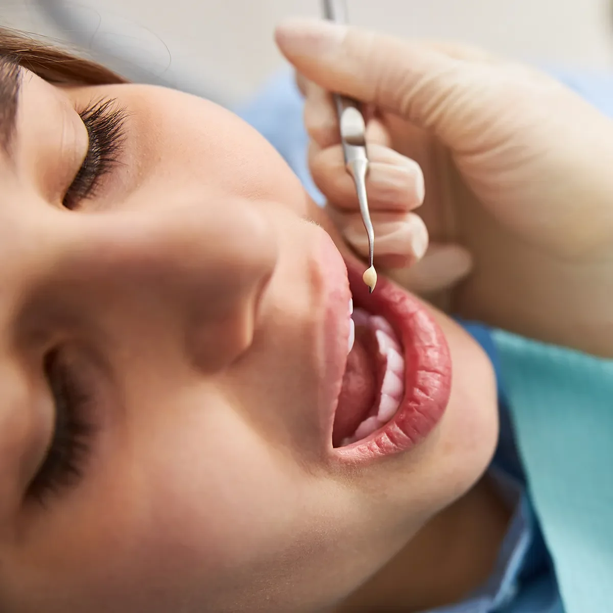 A woman undergoing dental fillings