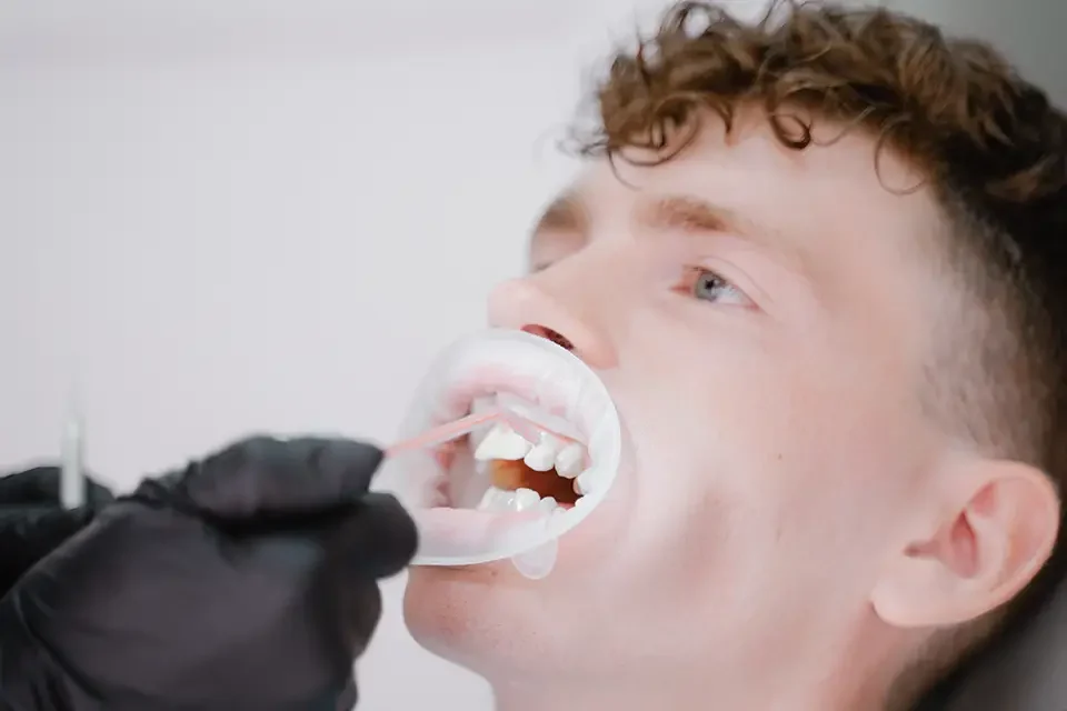 Dental Treatment #image_title