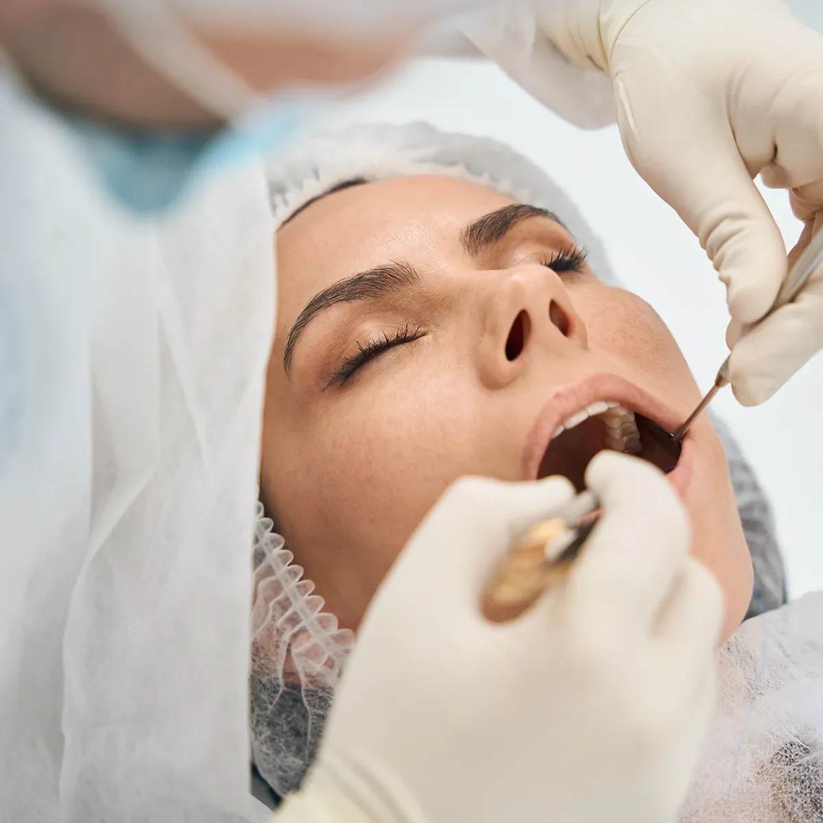 A visual presentation highlighting the excellence in Sedation Dentistry at Zara Dental Clinic. In this visual, the process of providing calming and anxiety-free dental care through sedation is illustrated, reflecting our commitment to ensuring a comfortable experience for every patient. At Zara Dental Clinic, our team of skilled professionals specializes in Sedation Dentistry, utilizing advanced techniques and technology to create a relaxed environment. Discover the tranquility and stress-free dental care with Sedation Dentistry at Zara, where your comfort and well-being are our top priorities
