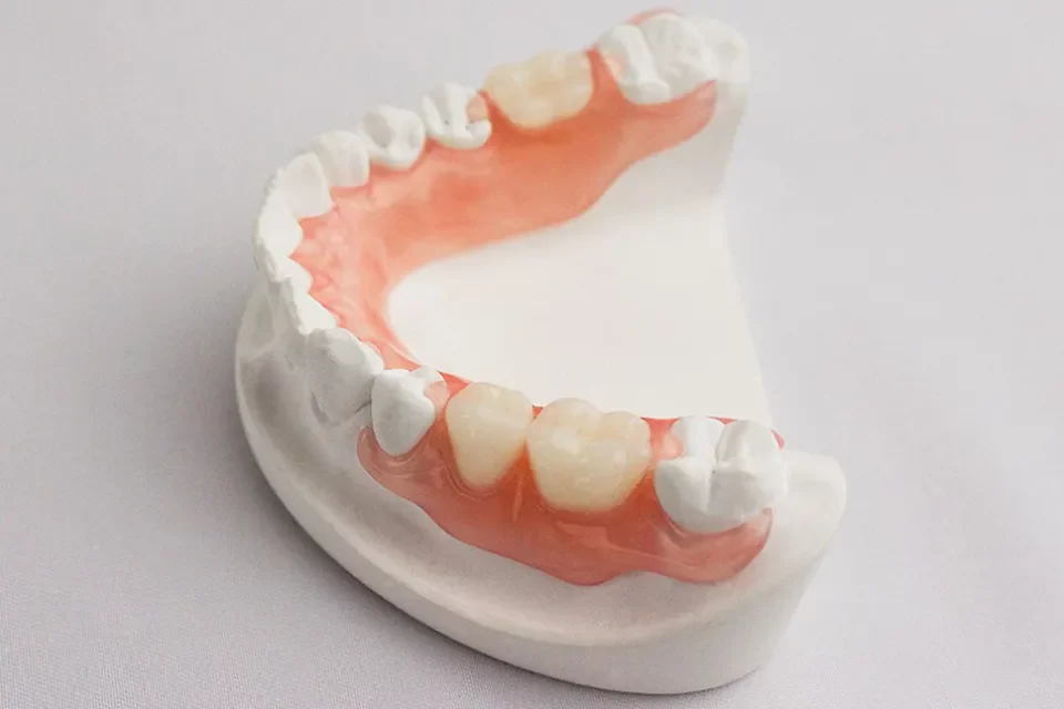 Valplast Dentures: A Closer Look at Comfort