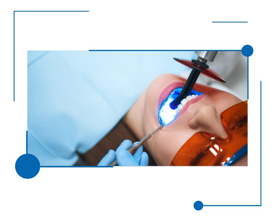 Best Teeth Bonding in Houston, Texas