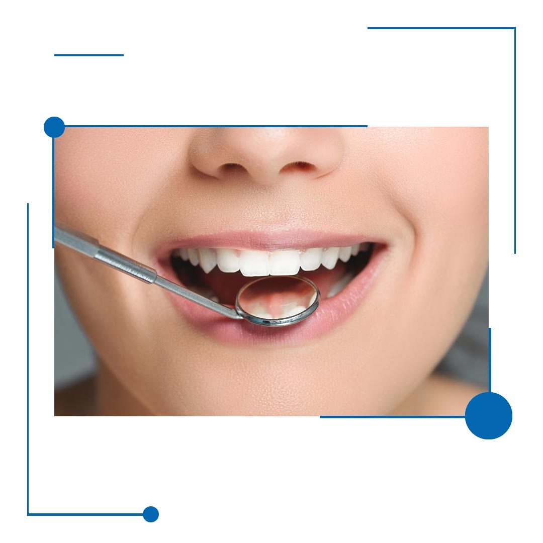 Best Bone Grafting in Houston, Texas