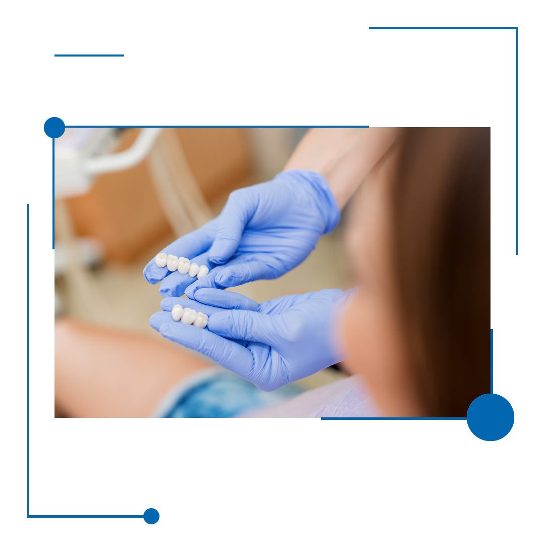 Best Dental Crowns in Houston, Texas