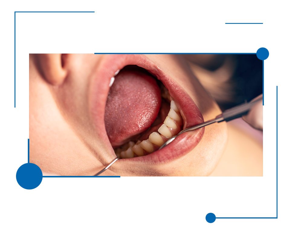 affordable Dental Exam in Houston, Texas
