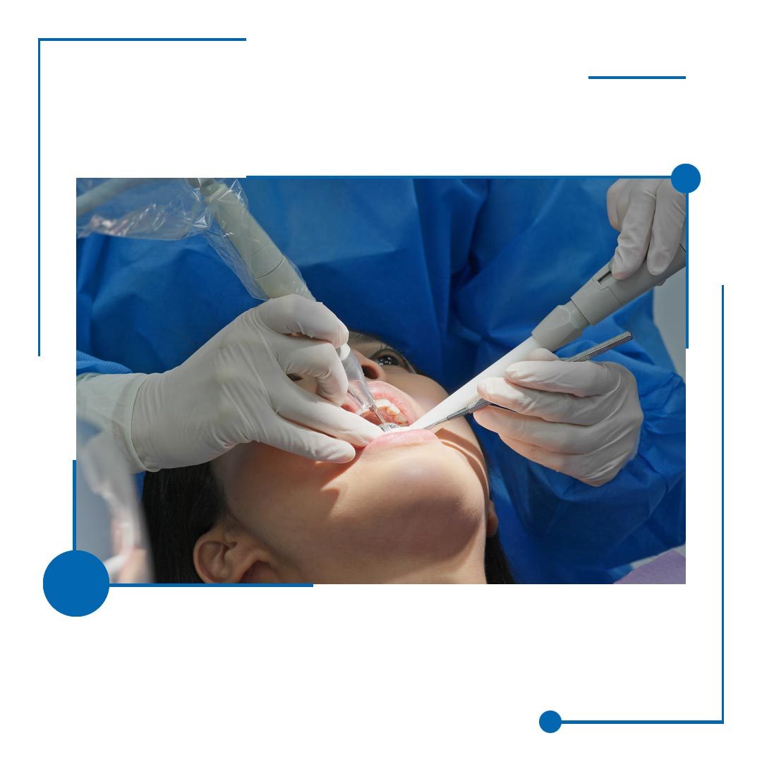Best Surgical Dental Extraction in Houston, Texas