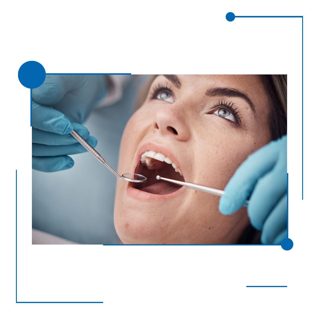 Professional Tooth Extractions in Houston, Texas