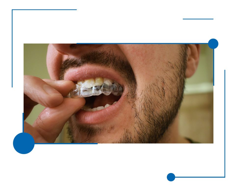 High Quality Invisalign in Houston, Houston