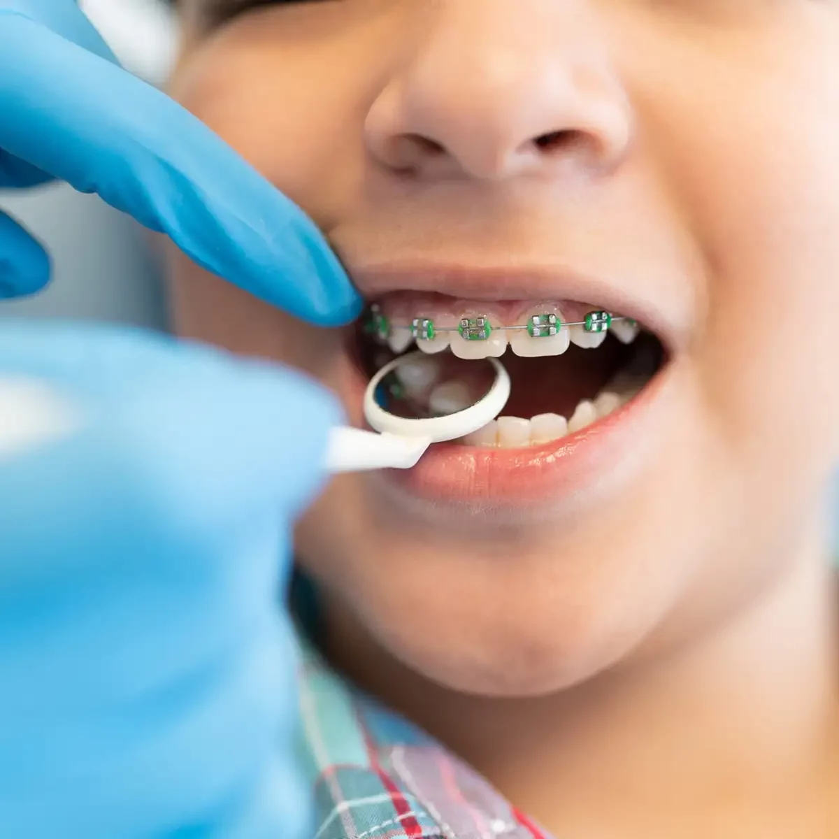 A child with braces at the dentist's office, receiving dental care, showcasing the importance of kids & teenagers braces to correct dental alignment