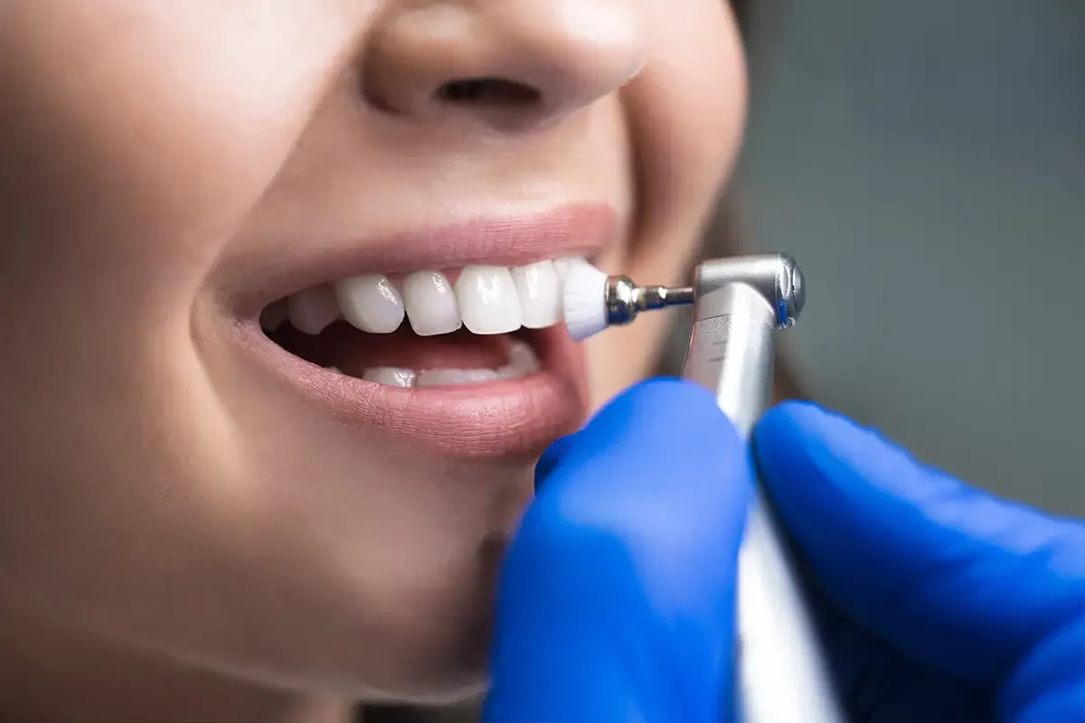 Woman undergoing teeth cleaning with dental tool for teeth whitening treatment