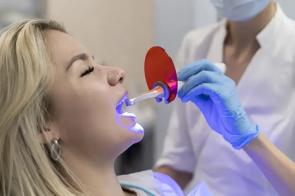 Lumineers Cost in Houston: What Really Affects the Price?