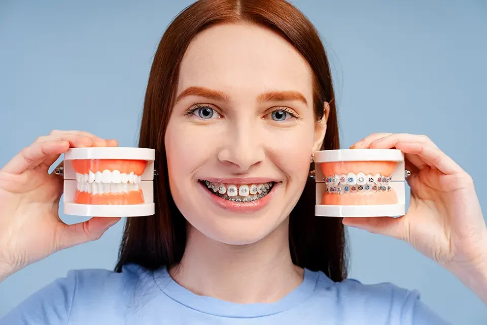 Cost of Lingual Braces