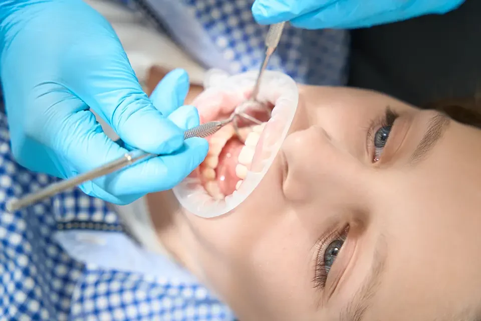 Types of Diastema