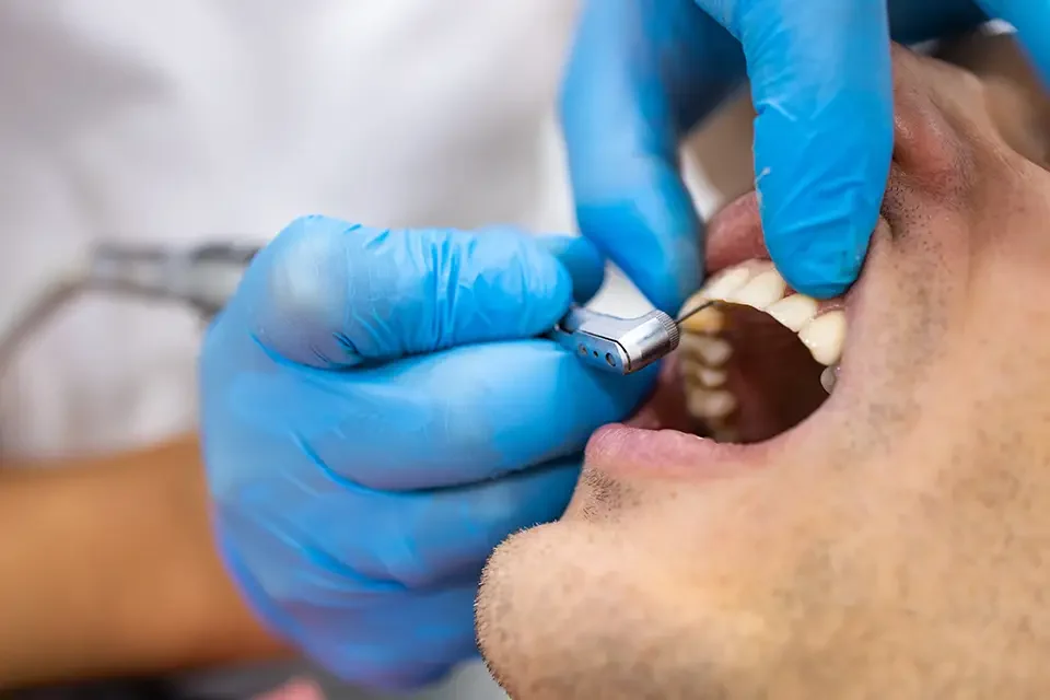 close-up-of-dental-drill-use-for-patient-teeth Advantages of Dental Flippers