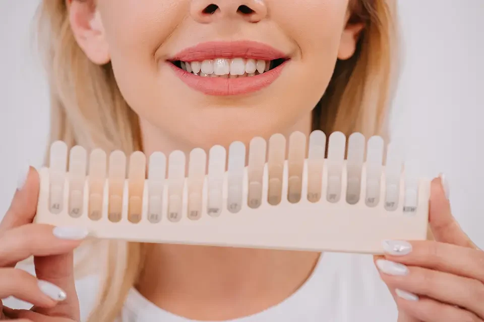 cropped-view-of-smiling-woman-holding-teeth-color Composite Veneers Cost in Houston