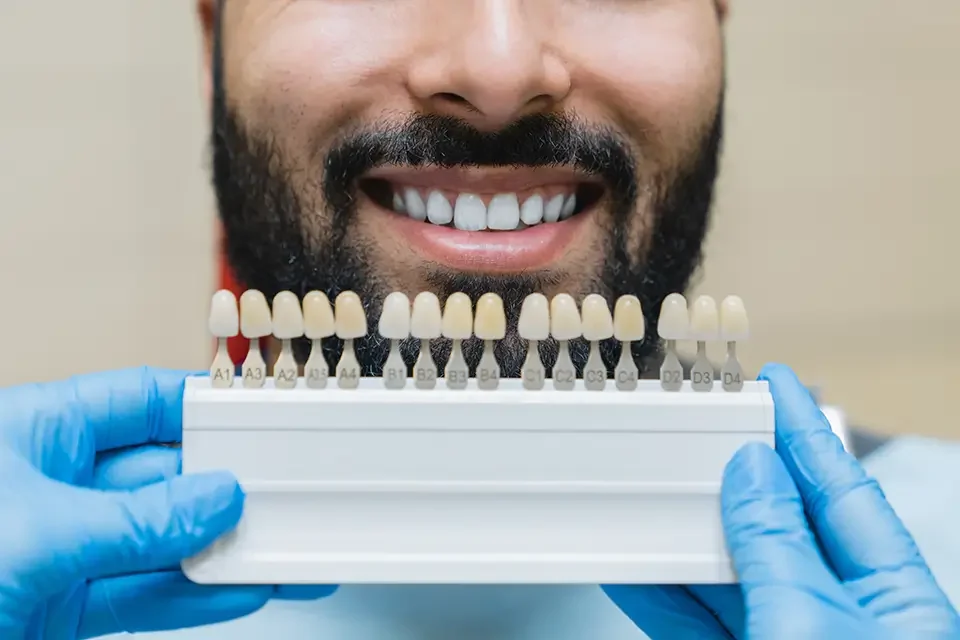 dental crown colors Factors Affecting Dental Crown Cost