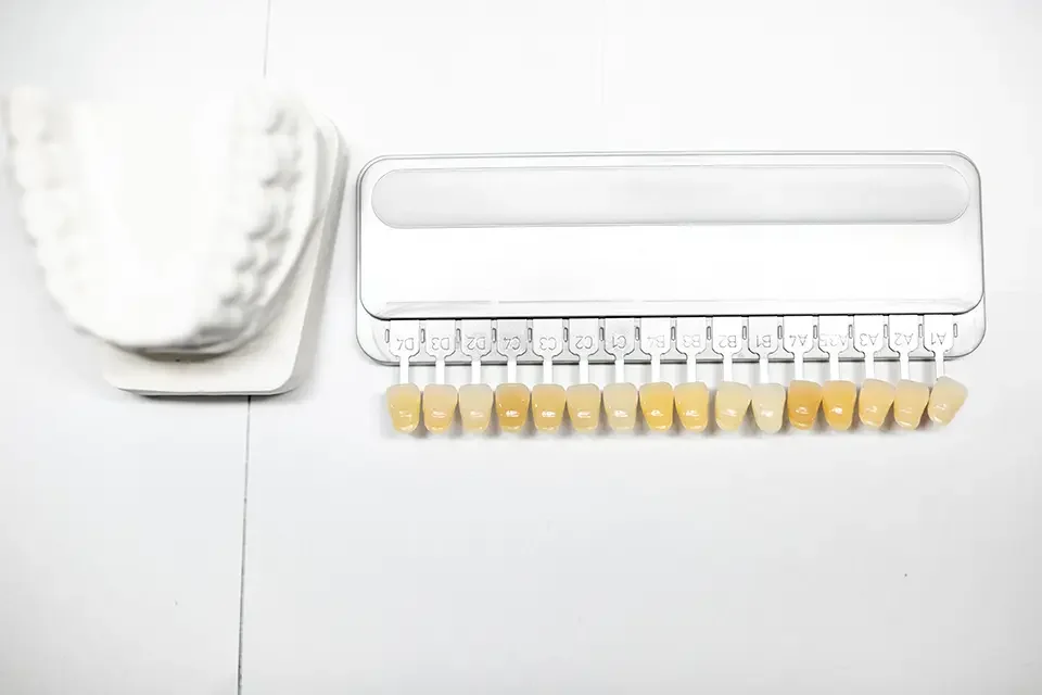 Dental Numbering Systems