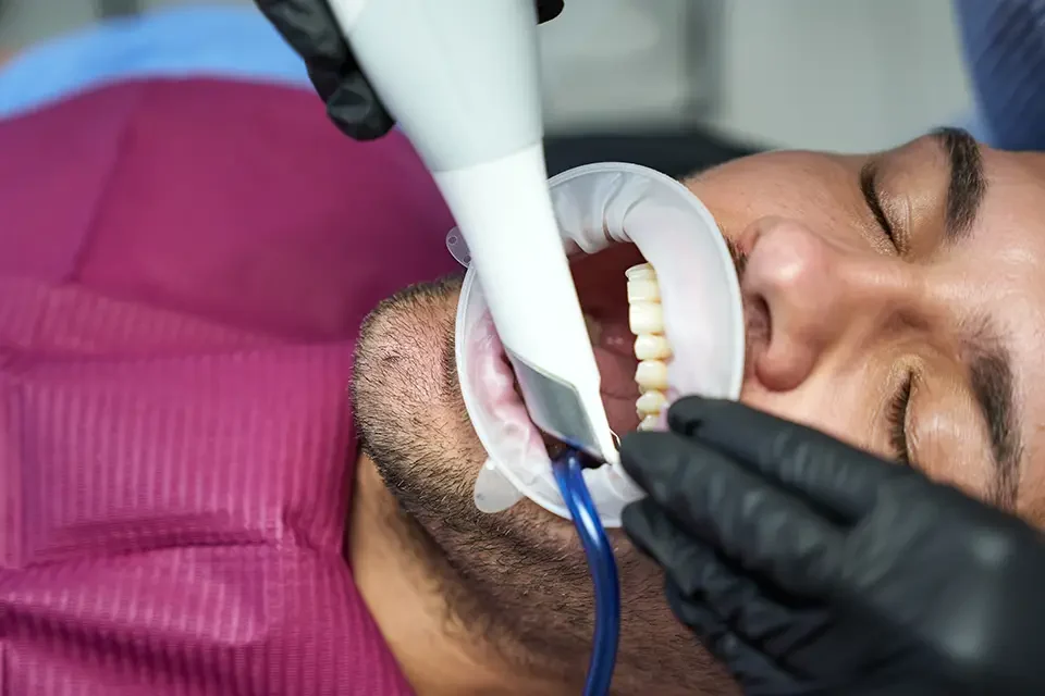 Deep Cleaning Teeth Cost in Houston