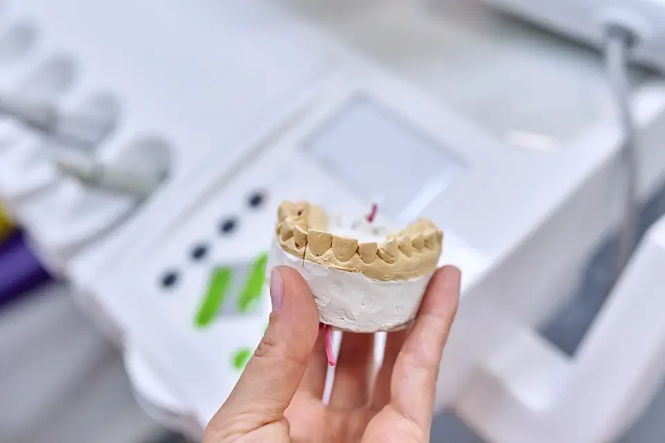 Step-by-Step: The CEREC Same-Day Crown Process