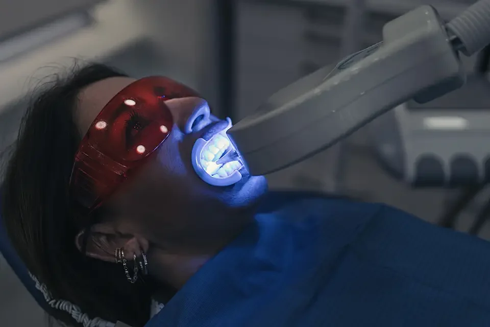Is Laser Teeth Whitening Right for You?