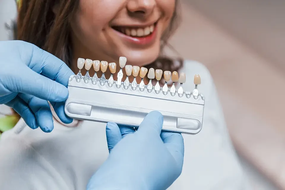 Cost of Porcelain Crowns