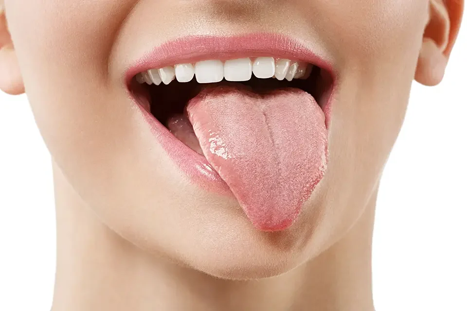 Causas Comunes de los Bultos en la Parte Posterior de la Lengua