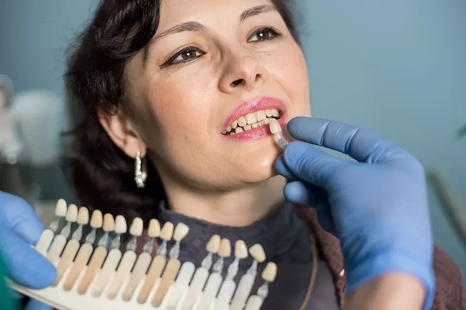veneer process Who Can Benefit from the Best Dental Veneers?